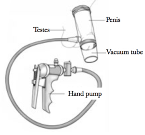 Dispositivo de vacio disfuncion erectil